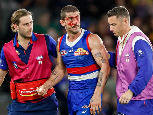 Tom Liberatore has been cleared to continue playing. (Photo by Dylan Burns/AFL Photos via Getty Images)