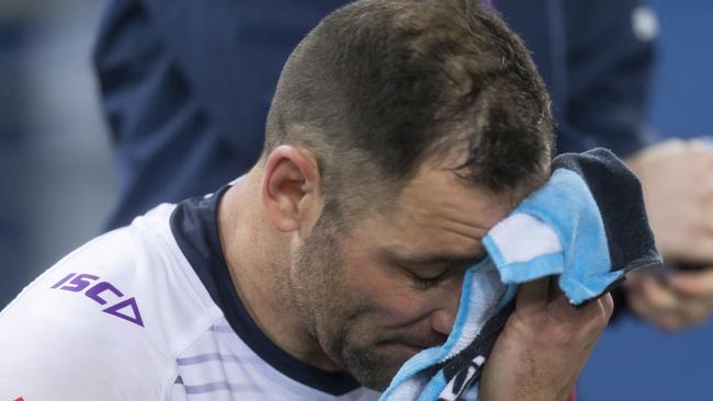 Cameron Smith was hurt late in the loss to South Sydney. (AAP Image/Craig Golding)