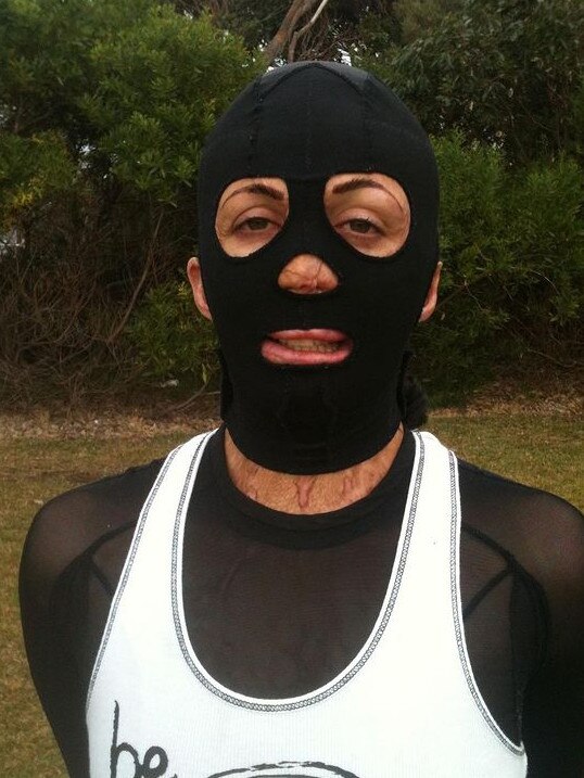 Turia Pitt in her compression mask, which she wore for two years to help her skin heal. (Picture: Supplied)