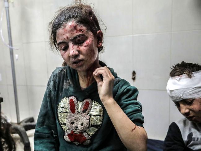 Injured children at Nasser Medical Hospital in Khan Yunis, Gaza, after Israeli air strikes. Picture: Getty Images