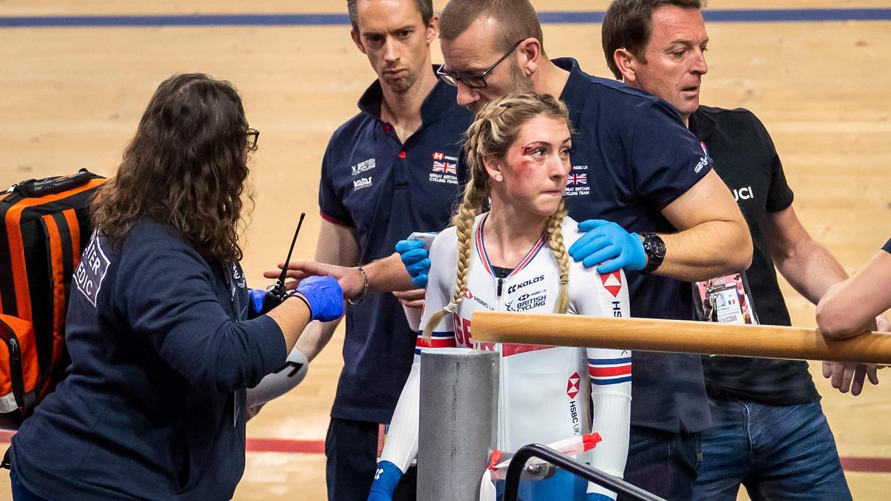 Great Britain's Laura Kenny was left bloodied after a crash at the Track Cycling World Championships
