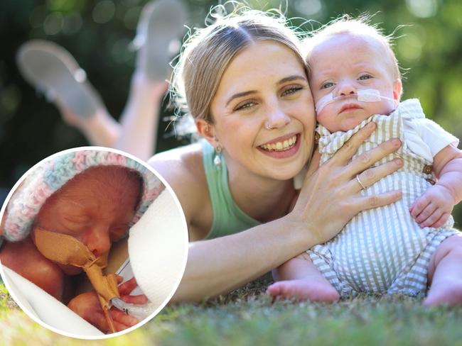 Ipswich Erika Brown mum has shared her heartache over her tiny baby, born just days after being considered âviableâ.