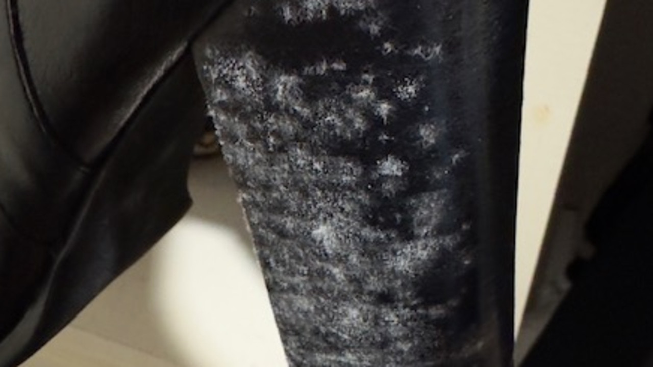 The mould on the jacket that started the nightmare. Picture: Supplied