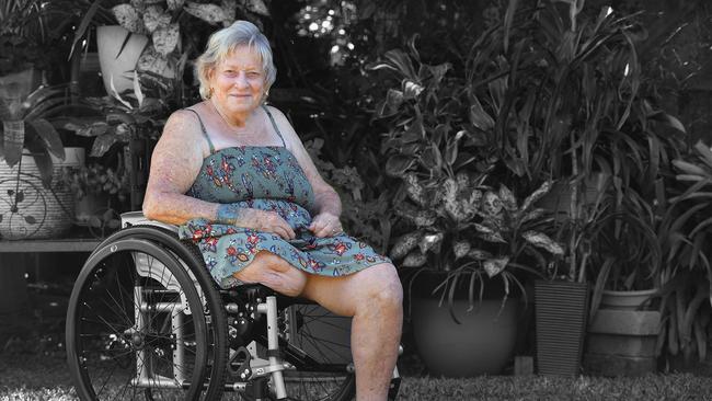 Chloe Callander talks about Life Beyond the Scars. Picture: Tony Martin