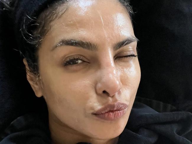 Actress Priyanka Chopra had a wild FaceGym facial before her appearance. Picture: Instagram/Priyanka Chopra