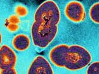 31/05/2005 PIRATE: Vancomycin resistant enterococci (VRE) bacteria, a life-threatening superbug as viewed under a microscope in 2005 image Pic. Supplied