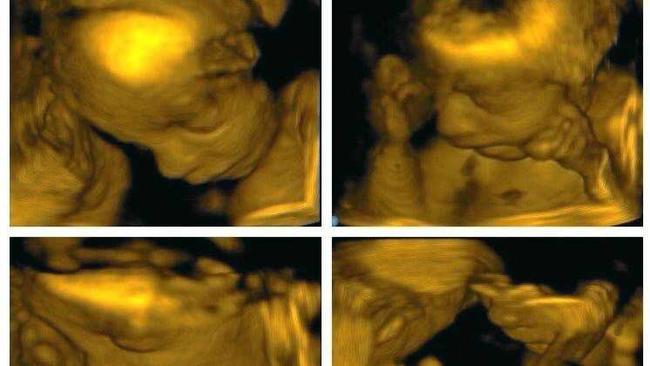 SNEAK PEEK: Kirsty Rogers offers a service allowing couples to see their babies in 3D. Picture: Kirsty Rogers