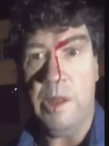 Brad Quirk was allegedly assaulted by 18-year-old Casey Holmes and her friend. Picture: Supplied