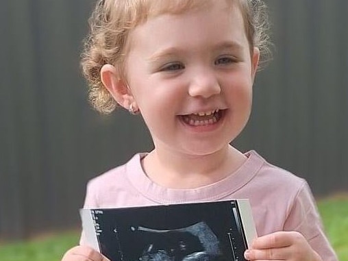 Doctors discovered a tumour in two-year-old Elenna Savorgnan's brain and spinal cord. Picture: Supplied