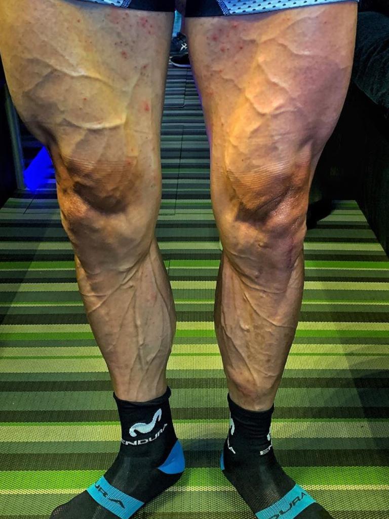 Jose Joaquin Rojas shows off his insane legs