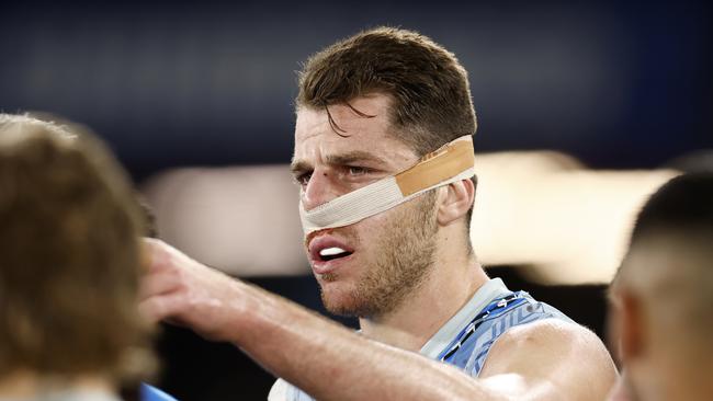 Kangaroo Tristan Xerri is patched up after leaving the field under the blood rule. Picture: Darrian Traynor/AFL Photos/Getty Images