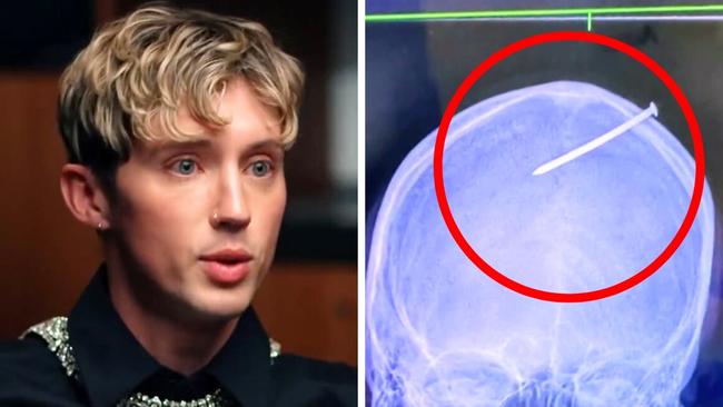 Troye Sivan and his father's horrifying injury. Picture: Channel 10.