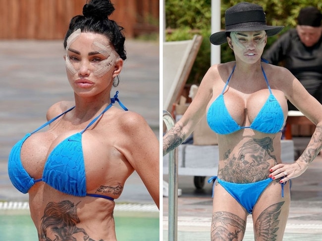 Katie Price recovers from sixth facelift poolside.