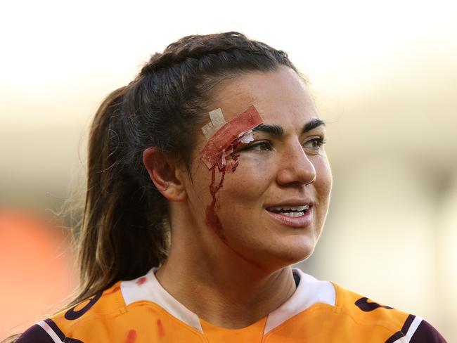 Millie Boyle of the Broncos carries some battle scars after the match against the St George Illawarra Dragons. Picture: Mark Kolbe/Getty Images