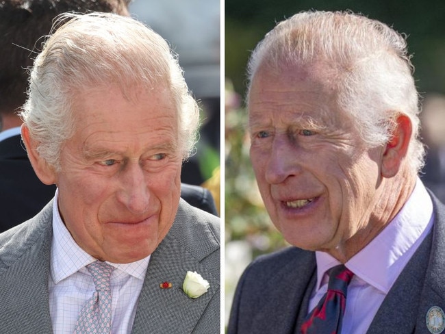 More than six months after King Charles revealed his cancer diagnosis, the palace can no longer hide the toll his health battle is taking. Pictures: Getty