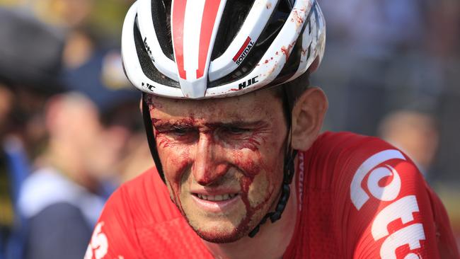 Belgium's Tiesj Benoot crosses the finish line with blood running down his face after crashing during the fourth stage of the Tour de France cycling race over 195 kilometres (121 miles) with start in La Baule and finish in Sarzeau, France, Tuesday, July 10, 2018. (AP Photo/Peter Dejong)