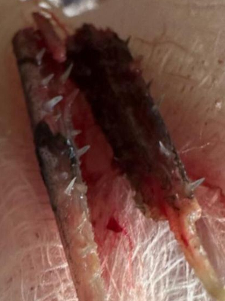 Part of the garfish beak that was removed from Mr Kezic’s nose. Picture: Steve Kazic