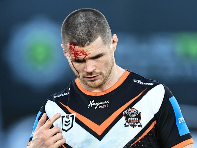 GOSFORD, AUSTRALIA - JULY 20: John Bateman  of the Tigers with a cut to his head during the round 20 NRL match between South Sydney Rabbitohs and Wests Tigers at Industree Group Stadium, on July 20, 2024, in Gosford, Australia. (Photo by Mark Evans/Getty Images)