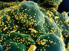 (FILES) In this undated handout image obtained July 15, 2020, courtesy of National Institute of Allergy and Infectious Diseases(NIH/NIAID), shows a colorized scanning electron micrograph of an apoptotic cell (blue/green) heavily infected with SARS-COV-2 virus particles (yellow), isolated from a patient sample, captured at the NIAID Integrated Research Facility (IRF) in Fort Detrick, Maryland. - US pharmaceutical company Eli Lilly's combination of two synthetic antibodies against Covid-19 reduced hospitalizations and deaths by 70 percent in high-risk patients with recent positive tests, the company said on January 26, 2021. Bamlanivimab and etesevimab together have the potential to be an important treatment that significantly reduces hospitalizations and death in high-risk COVID-19 patients, Lilly's chief scientific officer Daniel Skovronsky said. (Photo by Handout / National Institute of Allergy and Infectious Diseases / AFP) / RESTRICTED TO EDITORIAL USE - MANDATORY CREDIT AFP PHOTO /NATIONAL INSTITUTE OF ALLERGY AND INFECTIOUS DISEASES/HANDOUT  - NO MARKETING - NO ADVERTISING CAMPAIGNS - DISTRIBUTED AS A SERVICE TO CLIENTS