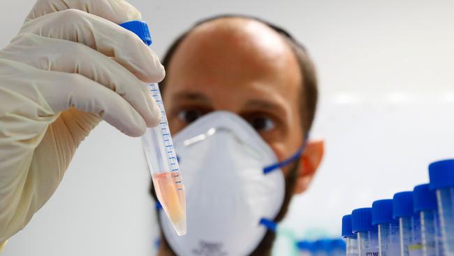 A lab technician holds a tube containing a swab sample taken for COVID-19. Picture: AFP