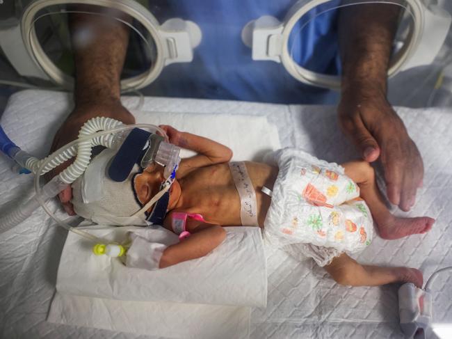 TOPSHOT - A medic cares for 'Sabreen al-Ruh al-Sheikh', a Palestinian baby delivered preterm by caesarian section minutes before the death of her mother, gravely injured in an Israeli air strike, at the Emirati hospital in Rafah in the southern Gaza Strip on April 24, 2024, amid the ongoing conflict between Israel and the Hamas movement. (Photo by AFP)