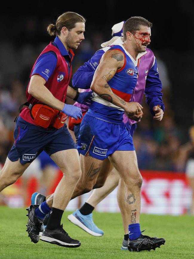 The Western Bulldogs’ Tom Liberatore leaves the ground against Hawthorn on Sunday after copping a head knock. Picture: Michael Klein