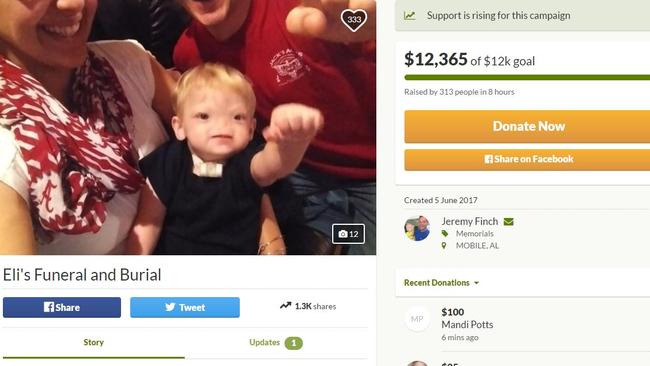 Boy born without a nose Eli Finch has died at the age of two | news.com ...