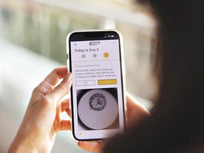 NETWORK SPECIAL.  MUST TALK WITH NETWORK PIC DESK BEFORE PUBLISHING.      Couples at Genea can follow the development of their embryos from day zero on an app called Grow. Pictures are taken of the embryos every seven to nine minutes. ,