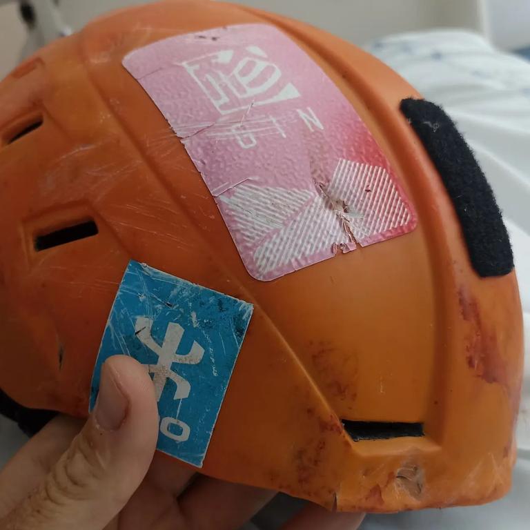 Nick’s other injuries included a subdural haematoma, aortic intimal tear and minor pulmonary contusions. Picture: Instagram/nneynens