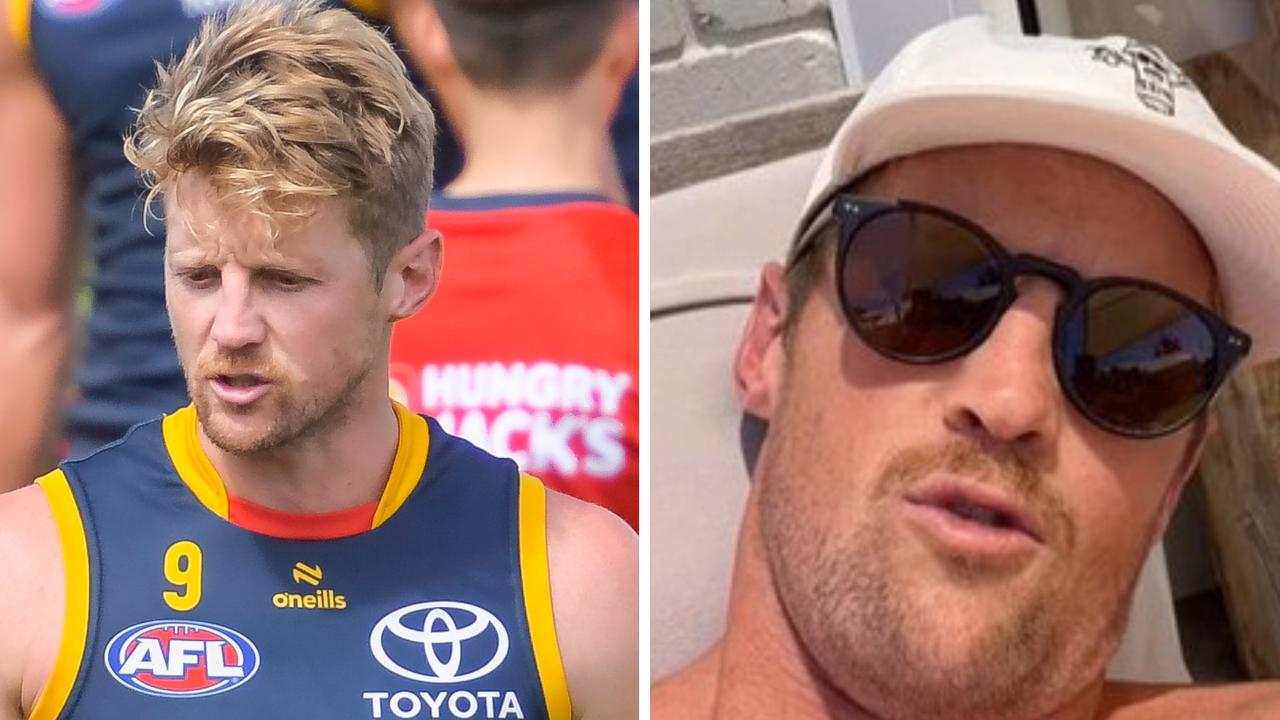 Rory Sloane has gone into extensive detail about his recent eye surgery.