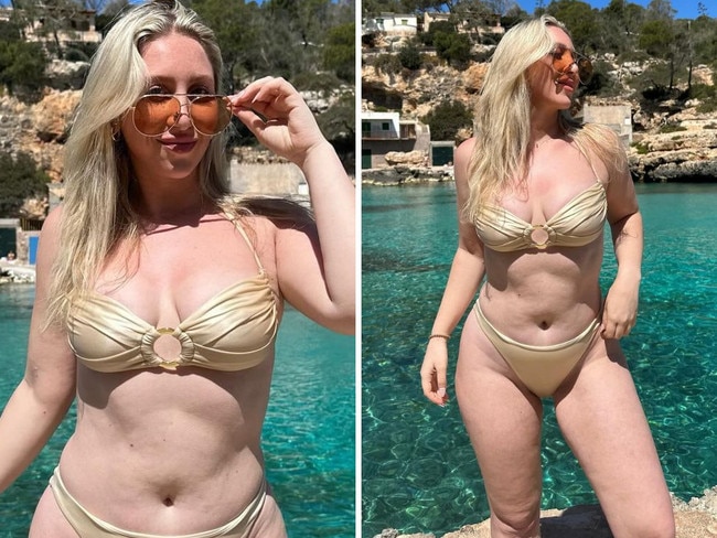 Sad reason woman’s ‘hot’ bikini pic went viral. Picture: Instagram/Carly_Weinstein