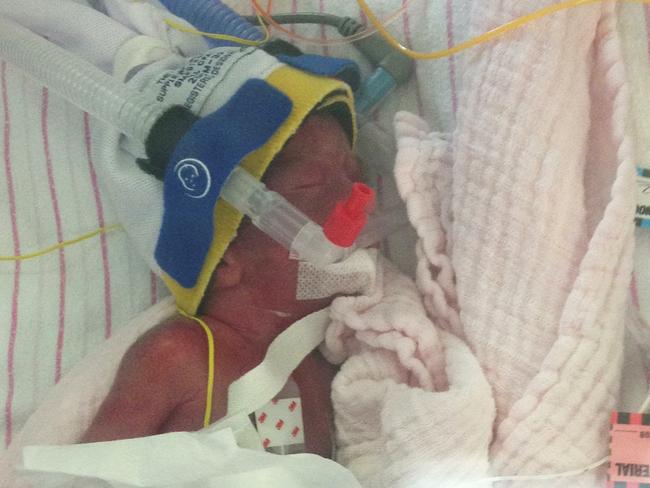 Premature baby, Elisabeth Wiltshire, taken on her birth day (12.12.2012). Picture: Supplied