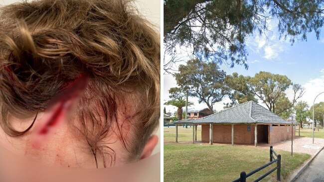 Police are investigating an attack an a German backpacker at a beach toilet block in Western Australia.