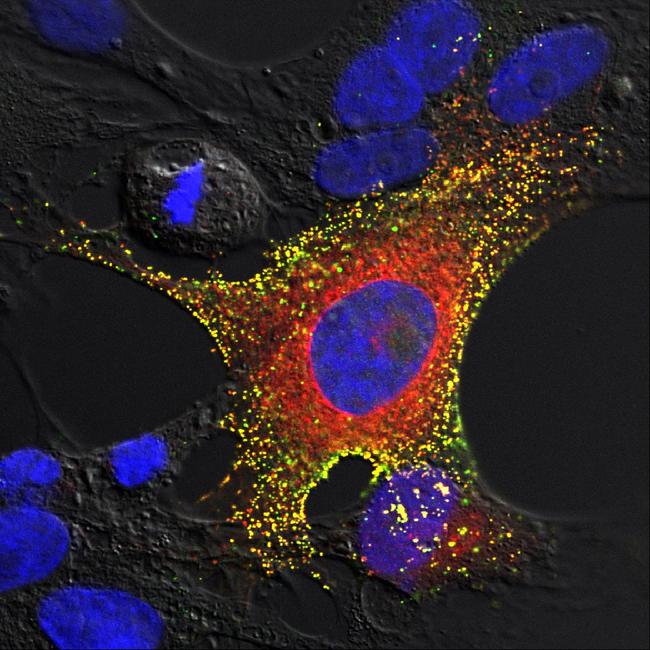 For the first time researchers have uncovered a unique ability in bats which allows them to carry but remain unaffected by lethal diseases. Here is a confocal microscopy of bat cells infected with the Hendra virus.