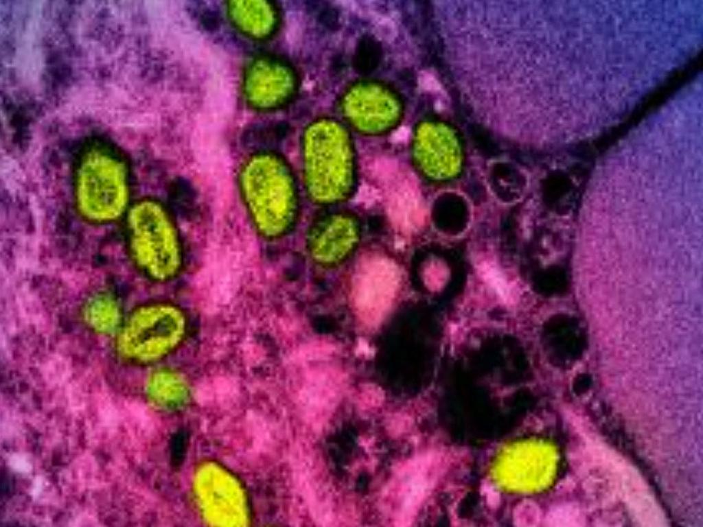 (FILES) This undated image obtained from the National Institute of Allergy and Infectious Diseases (NIAID) in Bethesda, Maryland, shows a colorized transmission electron micrograph of monkeypox particles (green) found within an infected cell (pink and purple), cultured in the laboratory. The World Health Organization on May 11, 2023, has declared that mpox no longer constitutes a global health emergency , almost exactly a year after the disease formerly known as monkeypox started spreading globally. WHO chief Tedros Adhanom Ghebreyesus said the decision was prompted by falling case numbers worldwide, but emphasised that the disease remains a threat, particularly in areas of Africa where it has long been present. (Photo by Handout / National Institute of Allergy and Infectious Diseases / AFP) / RESTRICTED TO EDITORIAL USE - MANDATORY CREDIT "AFP PHOTO / National Institute of Allergy and Infectious Diseases" - NO MARKETING NO ADVERTISING CAMPAIGNS - DISTRIBUTED AS A SERVICE TO CLIENTS