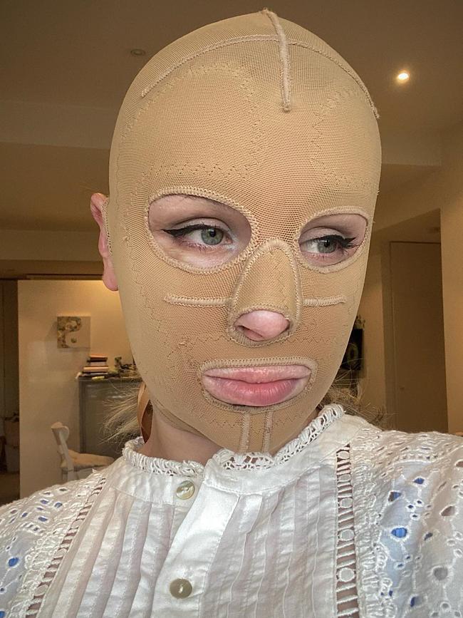 Ms Browitt wore a compression face bandage until recently. Source: Instagram/stephaniecoral96