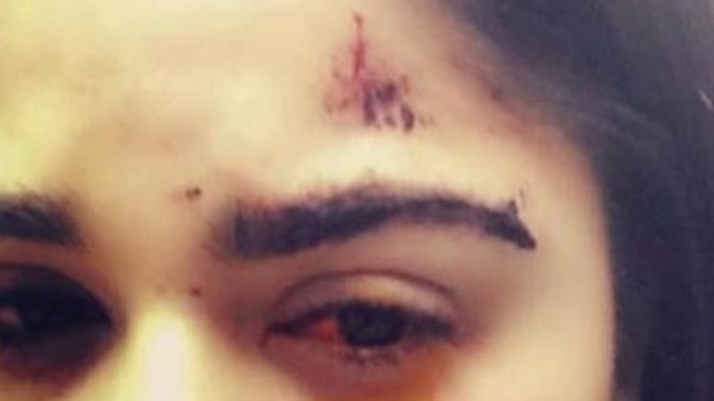 Joanna Christodoulou had her face cut when a man smashed her car window. Picture: Facebook