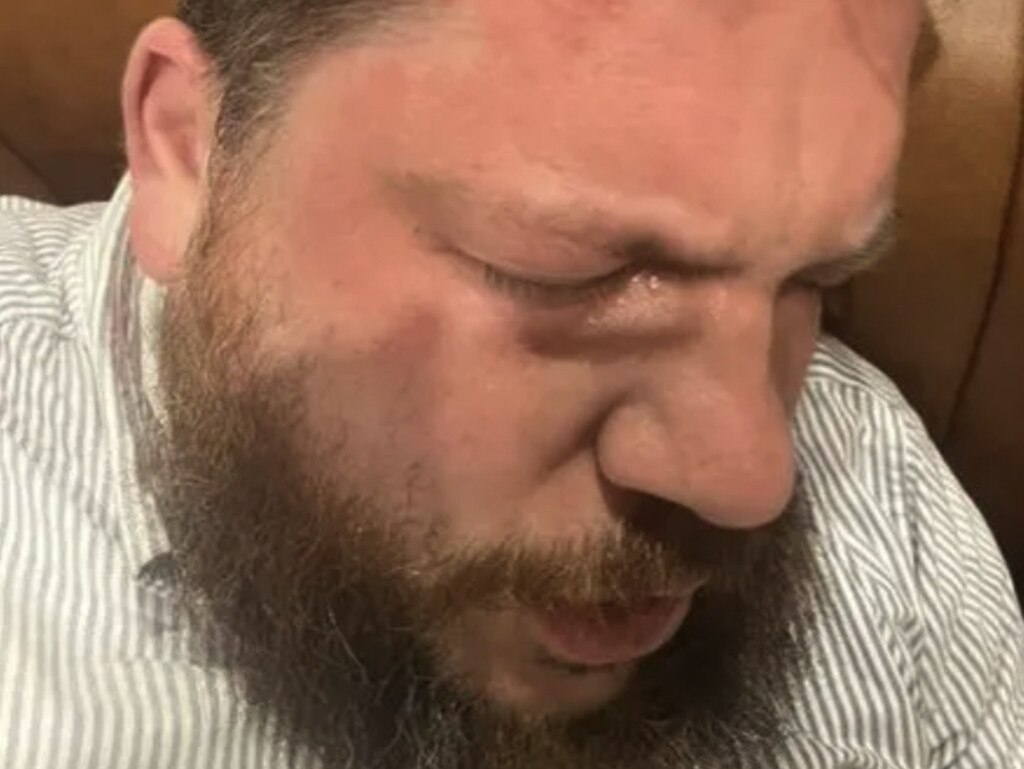 Leonid Volkov was hit with a hammer and pepper sprayed. Picture: X