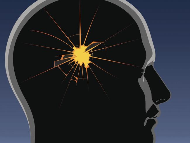 Headaches cost the economy $1 billion and lead to working days lost. Picture: Thinkstock