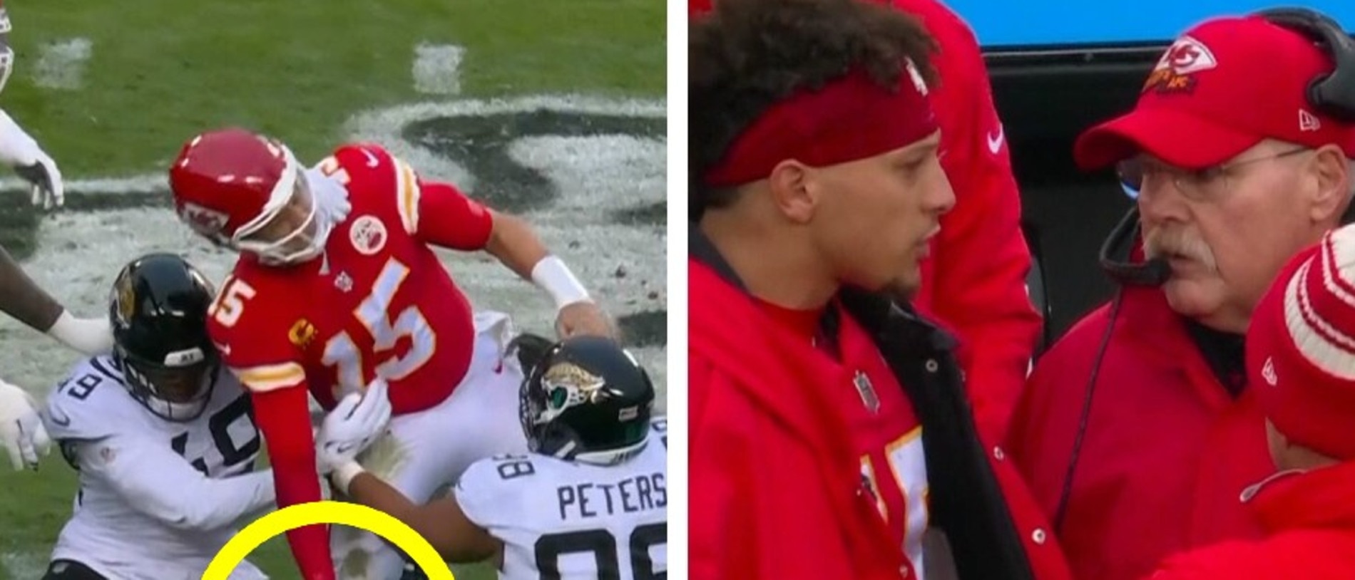 NFL playoffs: Mahomes shrugs off pain, plans to play