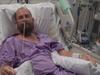 ‘Burnt to the bone’: Brave teacher crawls from campfire, loses leg