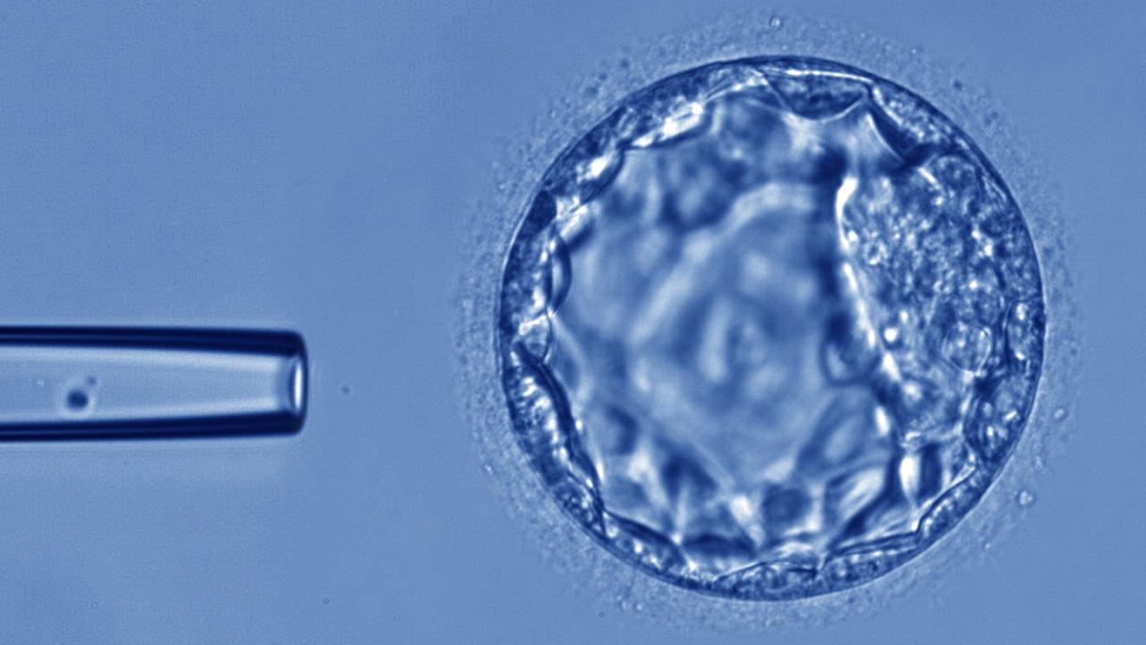 A profit update released to the market on Tuesday said Monash IVF is continuing to monitor the fallout from the mistaken embryo incident.