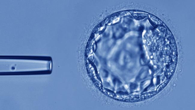 A profit update released to the market on Tuesday said Monash IVF is continuing to monitor the fallout from the mistaken embryo incident.