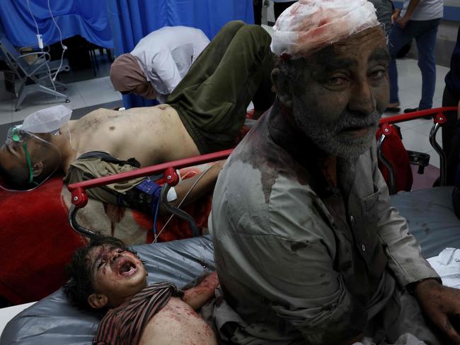 Wounded Palestinians wait for treatment at the overcrowded emergency ward of Al-Shifa hospital in Gaza City following an Israeli airstrike. Picture: AFP