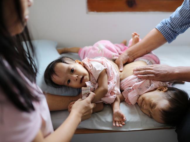 Nima and Dawa in the hospital ward they've spent most of their lives in. Picture: Alex Coppel