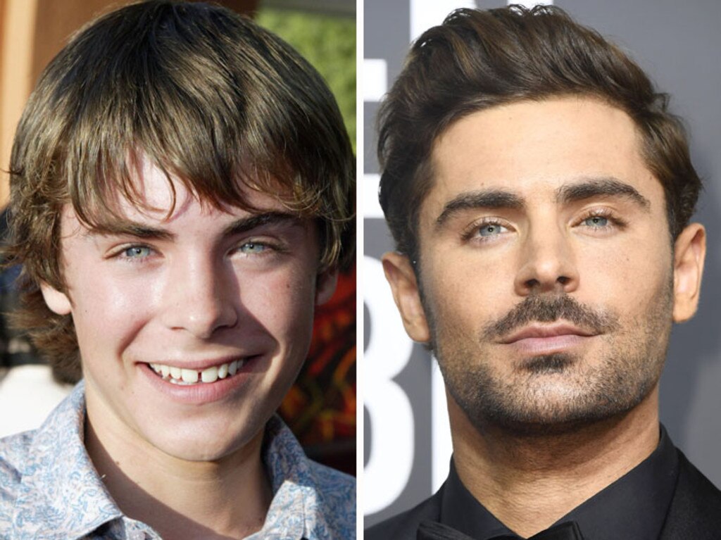 Zac Efron at 18, on the left, and current day Zac on the right. Picture: Getty Images