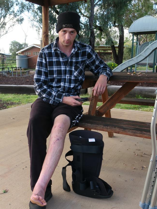 Jacob Ross six weeks after his motorcycle accident. Picture: Ryan Young