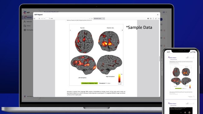 Inside the Australian Epilepsy Project's AI plan