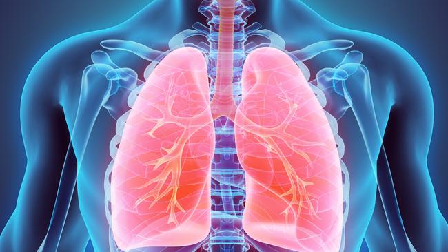 The “magical” drug can ­either stop or slow the growth of the rare lung cancer. 