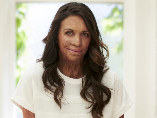 Health Hacker - Turia Pitt,